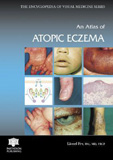 waptrick.com An Atlas of Atopic Eczema Encyclopedia of Visual Medicine Series
