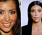 Before And After Kim Kardashian